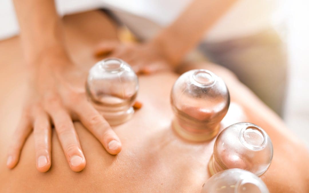 What Are the Benefits of Cupping?