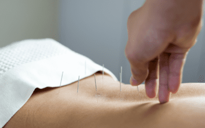 Acupuncture and Massage: Complementary Treatments