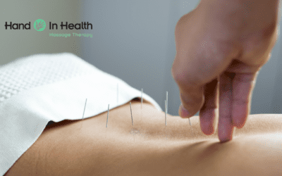 Should I See an Acupuncturist?