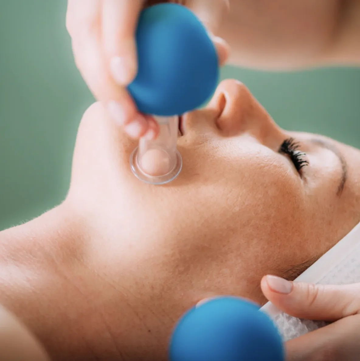 Lymphatic facial cupping with small blue facial cups on a patient's cheek